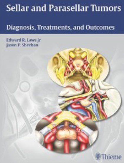 Sellar and Parasellar Tumors: Diagnosis, Treatments, and Outcomes PDF Free Download