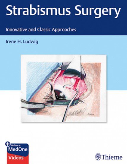 Strabismus Surgery PDF Free Download