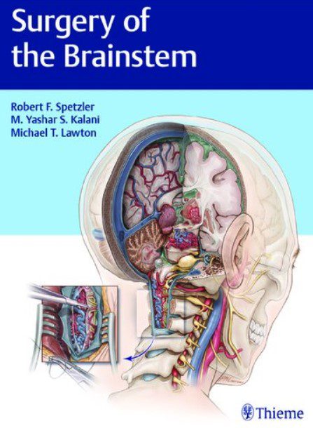 Surgery of the Brainstem PDF Free Download