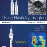 Tissue Elasticity Imaging Vol.1 PDF Free Download