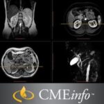 UCSF Abdominal & Thoracic Imaging 2019 Videos Free Download