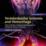 Vertebrobasilar Ischemia and Hemorrhage 2nd Edition PDF Free Download