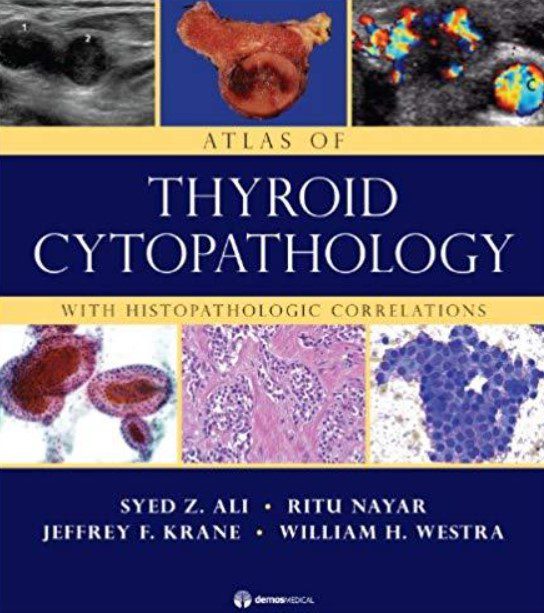 Atlas of Thyroid Cytopathology: With Histopathologic Correlations PDF Free Download