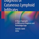 Diagnosis of Cutaneous Lymphoid Infiltrates PDF Free Download