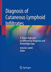 Diagnosis of Cutaneous Lymphoid Infiltrates PDF Free Download