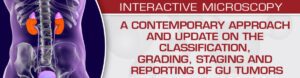 Download A Contemporary Approach and Update on the Classification, Grading, Staging and Reporting of GU Tumors Videos Free