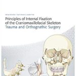 Download Principles of Internal Fixation of the Craniomaxillofacial Skeleton PDF Free