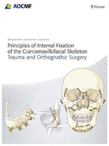 Download Principles of Internal Fixation of the Craniomaxillofacial Skeleton PDF Free