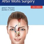 Facial Reconstruction After Mohs Surgery PDF Free Download
