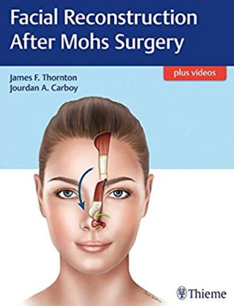 Facial Reconstruction After Mohs Surgery PDF Free Download