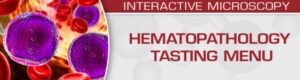Hematopathology Tasting Menu: A Sampling of Delightful Diagnostic Challenges 2021 Videos Free Download