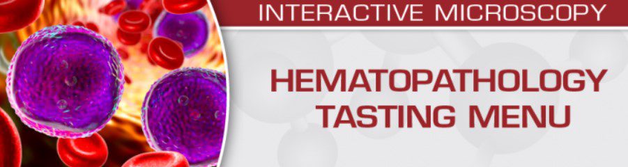 Download Hematopathology Tasting Menu: A Sampling of Delightful Diagnostic Challenges 2021 Videos Free