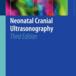 Neonatal Cranial Ultrasonography 3rd Edition PDF Free Download