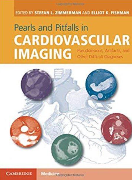 Pearls and Pitfalls in Cardiovascular Imaging PDF Free Download