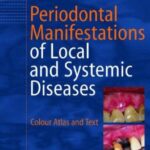Periodontal Manifestations of Local and Systemic Diseases PDF Free Download