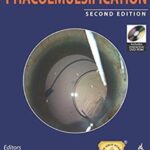 Phacoemulsification 2nd Edition PDF Free Download