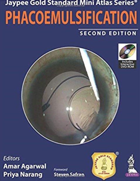 Phacoemulsification 2nd Edition PDF Free Download