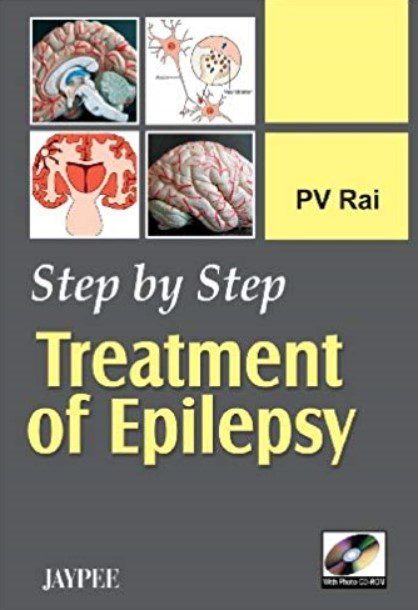 Step by Step Treatment of Epilepsy PDF Free Download