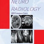 Atlas of Neuroradiology: 200 Common Cases PDF Free Download
