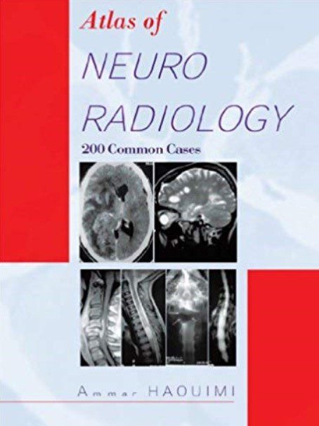 Atlas of Neuroradiology: 200 Common Cases PDF Free Download