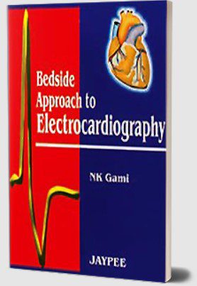 Bedside Approach to Electrocardiography by Gami NK PDF Free Download