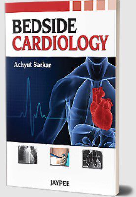 Bedside Cardiology by Achyut Sarkar PDF Free Download