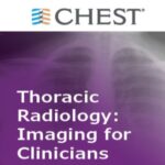 CHEST – Thoracic Radiology: Imaging for Clinicians Videos Free Download