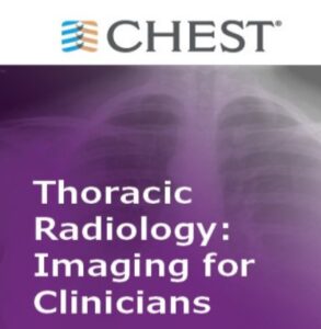 CHEST – Thoracic Radiology: Imaging for Clinicians Videos Free Download