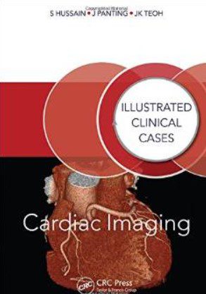 Cardiac Imaging: Illustrated Clinical Cases PDF Free Download