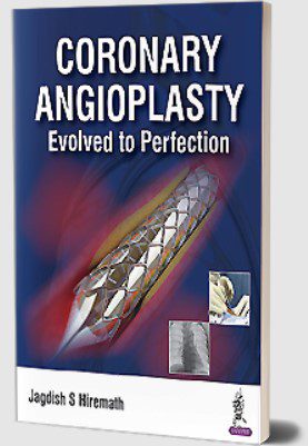Coronary Angioplasty: Evolved to Perfection by Jagdish S Hiremath PDF Free Download