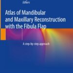 Download Atlas of Mandibular and Maxillary Reconstruction with the Fibula Flap PDF Free