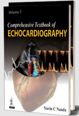 Download Comprehensive Textbook of Echocardiography (2 Volumes) by Navin C Nanda PDF Free