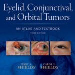 Download Eyelid, Conjunctival, and Orbital Tumors : An Atlas and Textbook 3rd Edition PDF Free