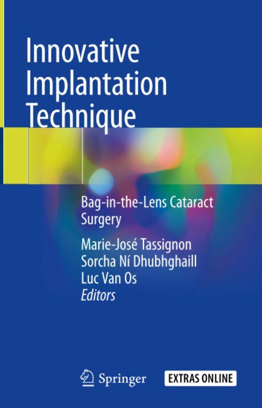 Download Innovative Implantation Technique: Bag-in-the-Lens Cataract Surgery PDF Free