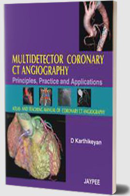 Download Multidetector Coronary CT Angiography: Principles, Practice and Applications PDF Free