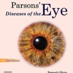 Download Parson’s Diseases of the Eye Pdf Free 23rd Edition