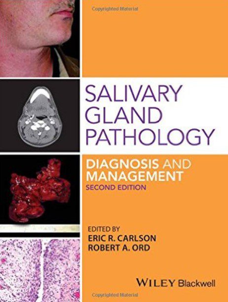 Download Salivary Gland Pathology Diagnosis and Management 2nd Edition PDF Free