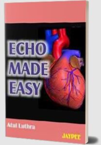 Echo by Atul Luthra PDF Free Download