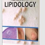 Handbook of Lipidology by Tapan Ghose PDF Free Download