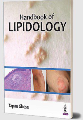 Handbook of Lipidology by Tapan Ghose PDF Free Download