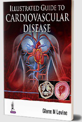 Illustrated Guide to Cardiovascular Disease by Glenn N Levine PDF Free Download