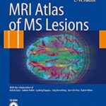 MRI Atlas of MS Lesions PDF Free Download