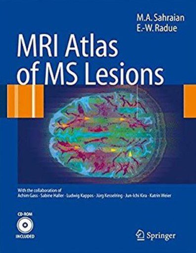MRI Atlas of MS Lesions PDF Free Download