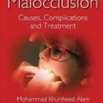 Malocclusion: Causes, Complications and Treatment PDF Free Download