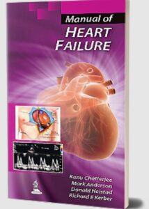 Manual of Heart Failure by Kanu Chatterjee PDF Free Download