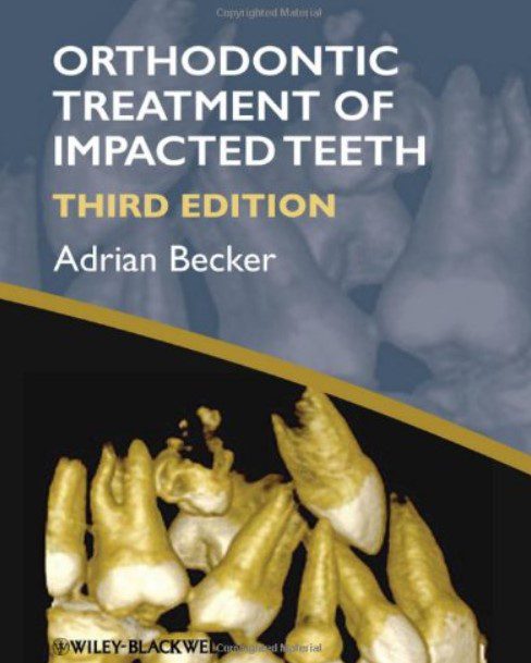 Orthodontic Treatment of Impacted Teeth 3rd Edition PDF Free Download