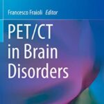 PET/CT in Brain Disorders PDF Free Download