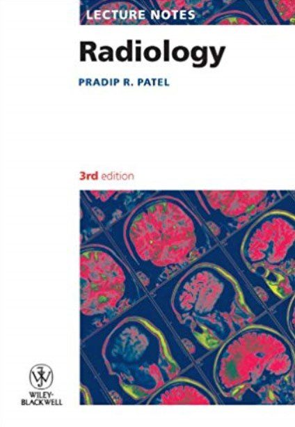 Radiology: Lecture Notes 3rd Edition PDF Free Download