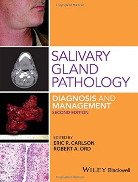 Salivary Gland Pathology Diagnosis and Management 2nd Edition PDF Free Download