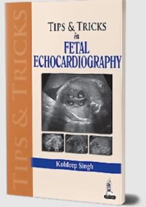 Tips & Tricks in Fetal Echocardiography by Kuldeep Singh PDF Free Download